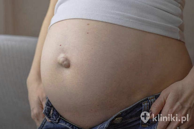 Czy pępek w ciąży zawsze się uwypukla? Kiedy to norma
