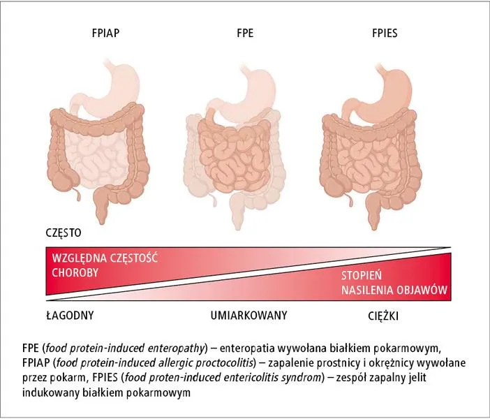 Alternatywy mleczne dla niemowląt