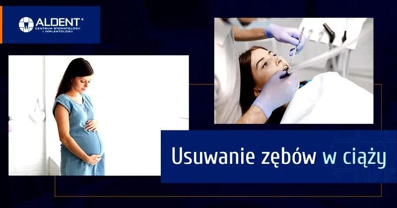 Bezpieczeństwo ekstrakcji zęba