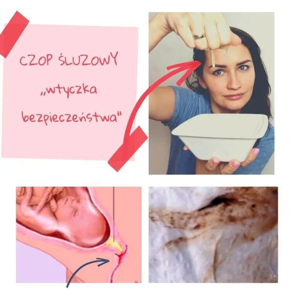 Czop śluzowy w ciąży