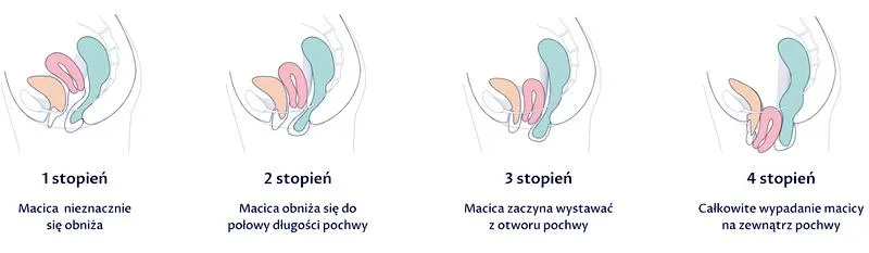 Diagnostyka problemów ginekologicznych