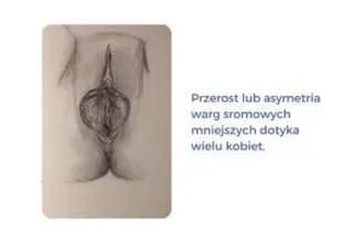 Dolegliwości intymne po porodzie