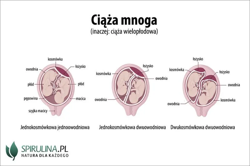 Domowe sposoby na rozluźnienie brzucha