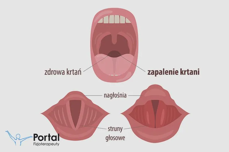 Farmakologiczne terapie