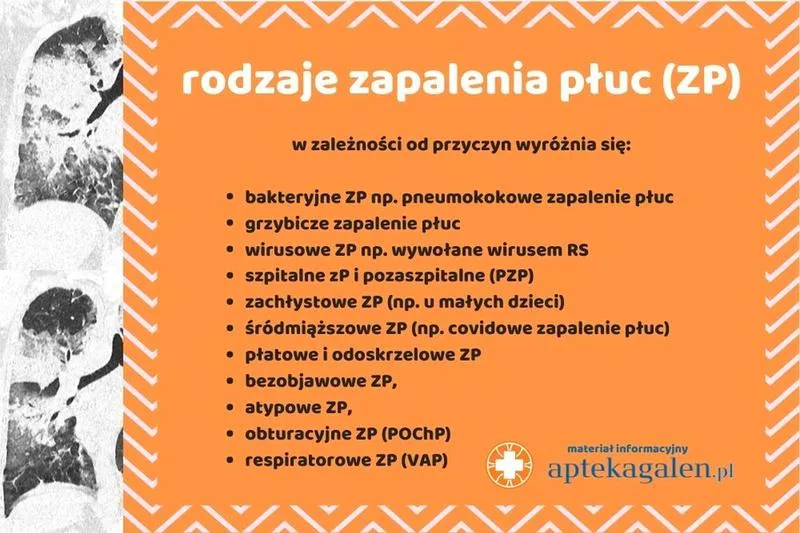 Hospitalizacja dzieci