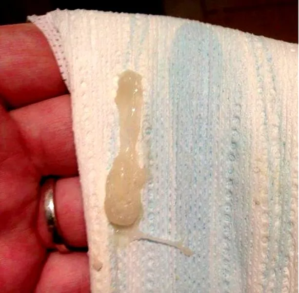 Konsystencja i kolor śluzu