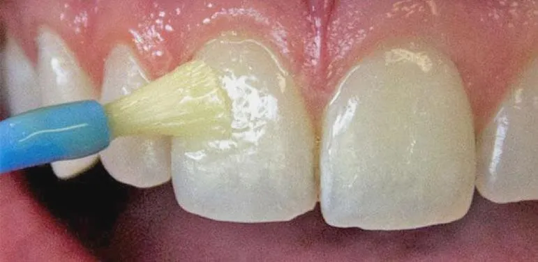 Miti i fakty o dentystyce