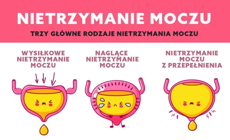 Nietrzymanie moczu po porodzie