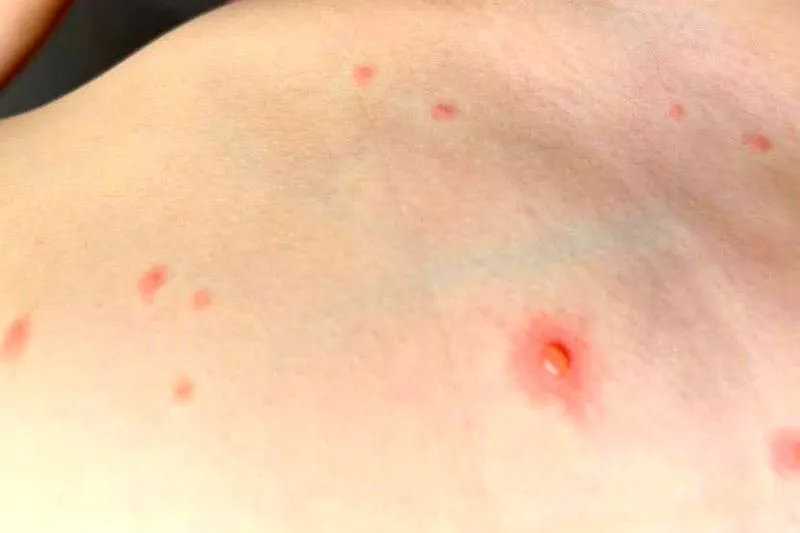 Pielęgnacja skóry dziecka