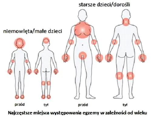 Pielęgnacja skóry w ciąży