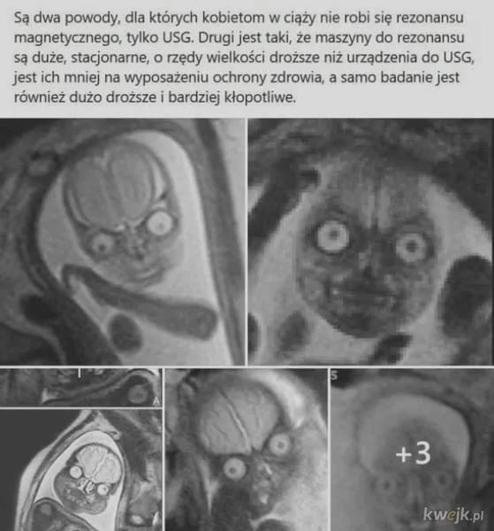 Rezonans magnetyczny w ciąży