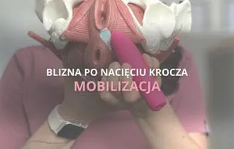 Terapia manualna blizn