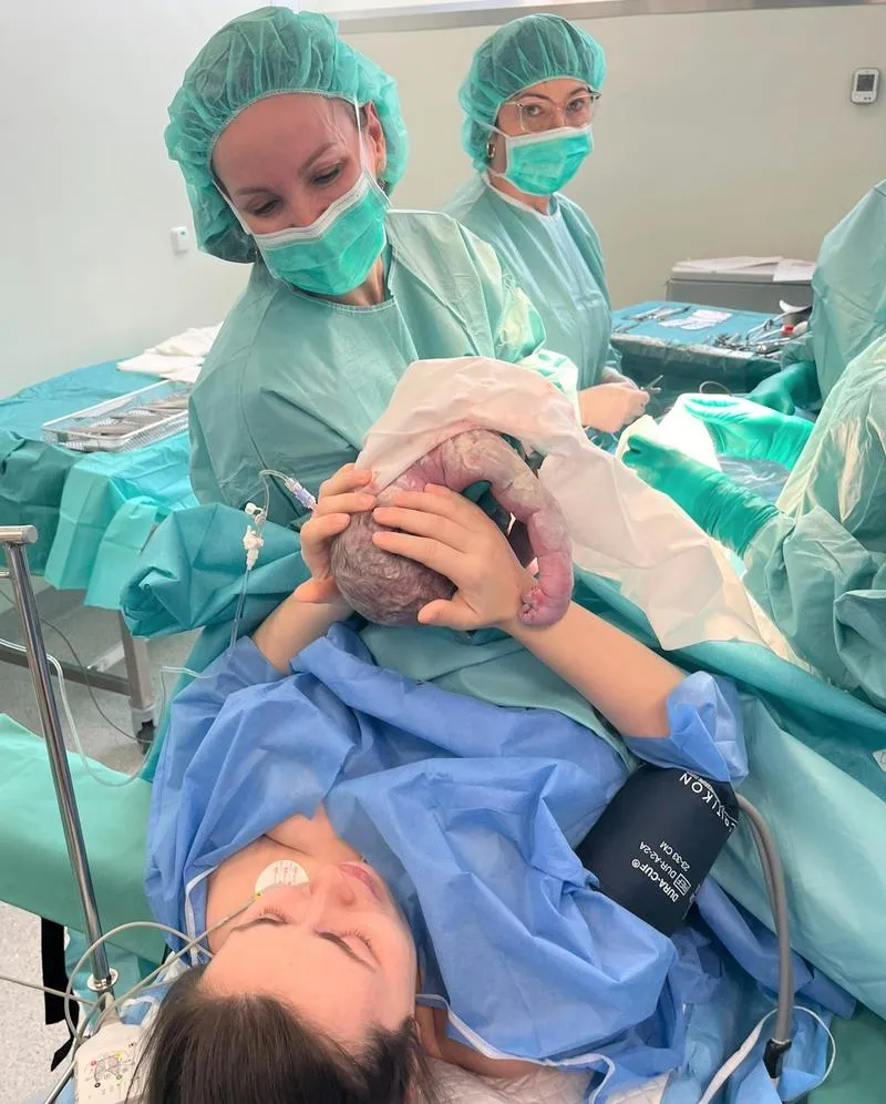 Zdjęcie szwów po porodzie